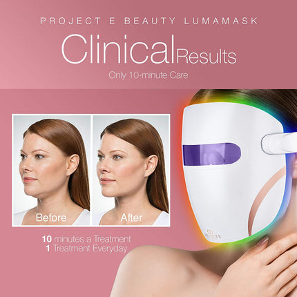 Lumamask LED Light Therapy by  | 7 LED Colors | Anti-Aging Skincare | Reduce Fine Lines & Wrinkles | Skin Tightening | Lightweight & Wireless