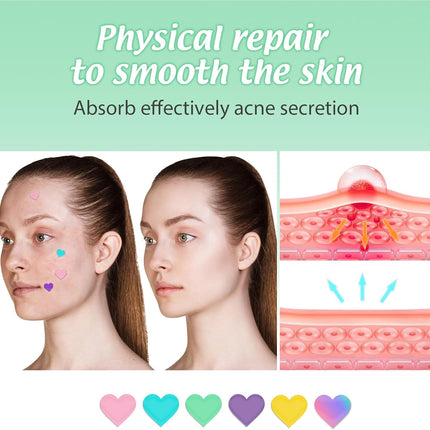 Pimple Patches Spot Patches Spot Stickers Acne Treatment Absorbing Cover Invisible Blemish Cover Acne Dots for Fast Acting Skincare