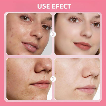 Jelly Mask,Jelly Face-Mask,Jelly Mask for Face,Natural Rose Jelly Mask,Rose Smoothing Facial Mask,Moisturizing Facial Mask,Jelly Face-Mask for Skincare,Skincare Moisturizing Gel Mask