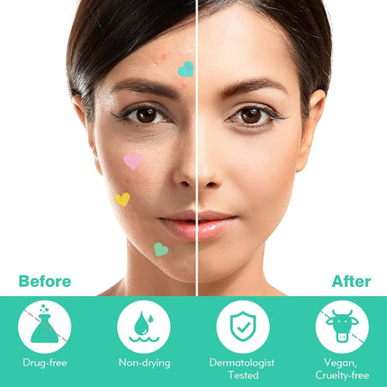 Pimple Patches Spot Patches Spot Stickers Acne Treatment Absorbing Cover Invisible Blemish Cover Acne Dots for Fast Acting Skincare