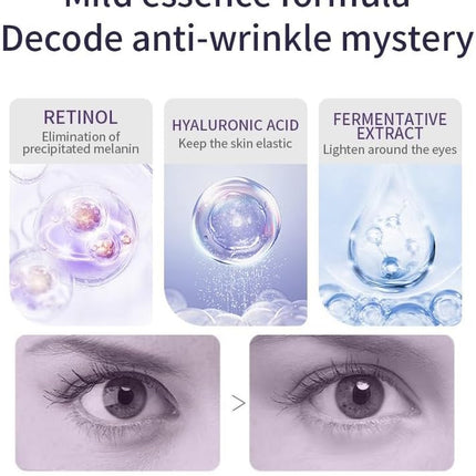 Retinol Eye Cream-Eye Cream for Dark Circles and Puffy Eyes,Anti-Aging Eye Cream with Retinol Serum,Hyaluronic Acid,Retinol Serum-Anti Wrinkle Eye Cream-Moisturising Eye Bags Remover