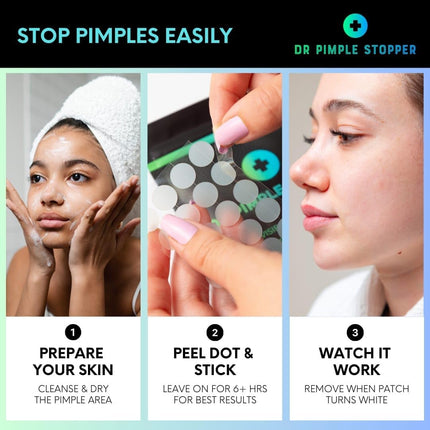 Acne Spot Patches Pack of 24 Translucent Hydrocolloid Infused with Centella Asiatic Oil Patch Spot Treatment Stickers for Face and Body - Fast-Acting, Invisible Korean Skincare