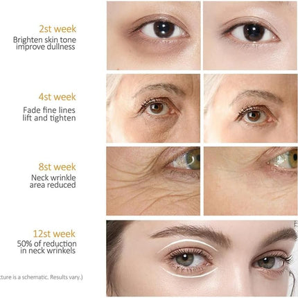 Retinol Eye Cream-Eye Cream for Dark Circles and Puffy Eyes,Anti-Aging Eye Cream with Retinol Serum,Hyaluronic Acid,Retinol Serum-Anti Wrinkle Eye Cream-Moisturising Eye Bags Remover